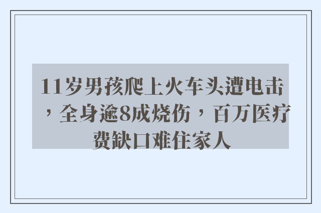 11岁男孩爬上火车头遭电击，全身逾8成烧伤，百万医疗费缺口难住家人